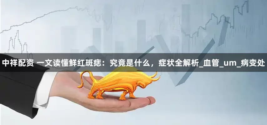 中祥配资 一文读懂鲜红斑痣：究竟是什么，症状全解析_血管_um_病变处